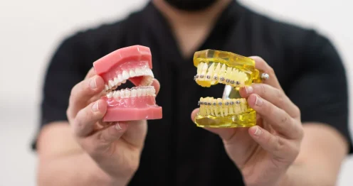Thermoplastic vs Traditional Denture Adhesives A stronger Hold for Modern Smiles